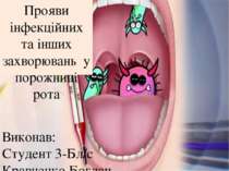 Прояви інфекційних та інших захворювань у порожнині рота