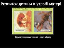 Восьмитижнева дитина до і після аборту Розвиток дитини в утробі матері