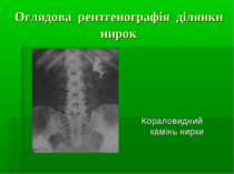 Оглядова рентгенографія ділянки нирок Кораловидний камінь нирки