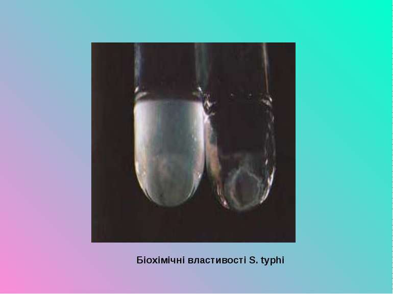 Біохімічні властивості S. typhi