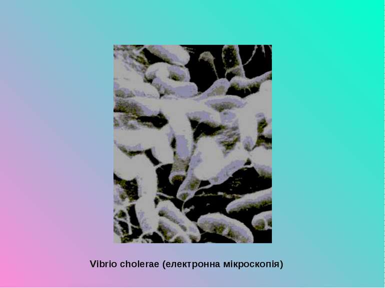 Vibrio cholerae (електронна мікроскопія)