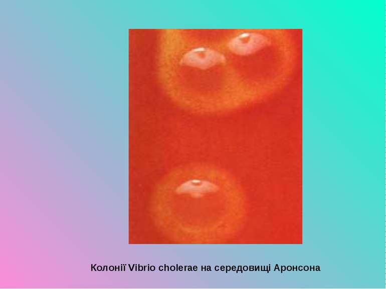 Колонії Vibrio cholerae на середовищі Аронсона