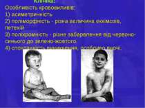 Клініка: Особливість крововиливів: 1) асиметричність 2) поліморфність - різна...