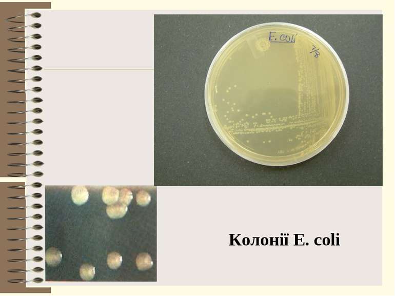 Колонії E. coli
