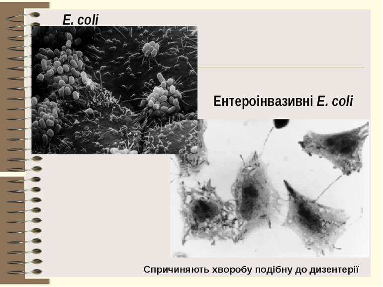 E. coli Ентероінвазивні E. coli Спричиняють хворобу подібну до дизентерії