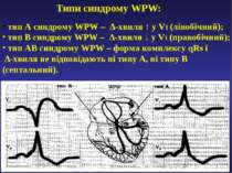 Типи синдрому WPW: тип А синдрому WPW – ∆-хвиля ↑ у V1 (лівобічний); тип В си...