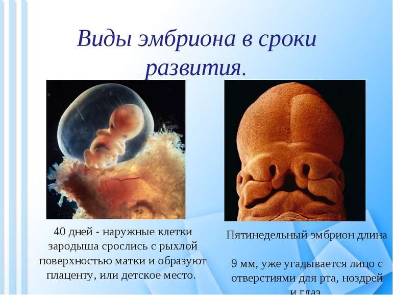 Виды эмбриона в сроки развития. Пятинедельный эмбрион длина 9 мм, уже угадыва...