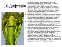 16.Дифтерія Гостре інфекційне захворювання, хар-ться переважно фібринозним за...