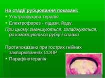 На стадії рубцювання показані: Ультразвукова терапія Електрофорез - лідази, й...