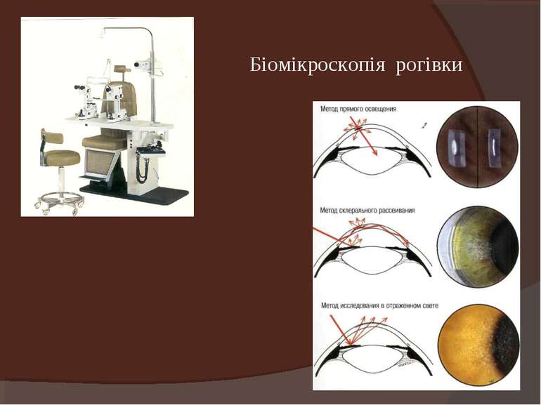 Біомікроскопія рогівки