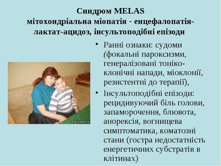 Синдром MELAS мітохондріальна міопатія - енцефалопатія-лактат-ацидоз, інсульт...