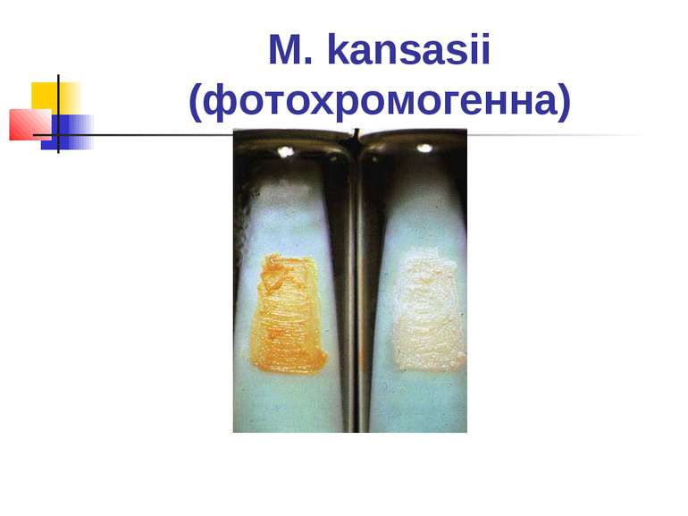 M. kansasii (фотохромогенна)
