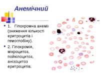 Анемічний 1.   Гіпохромна анемія (зниження кількості еритроцитів і гемоглобін...