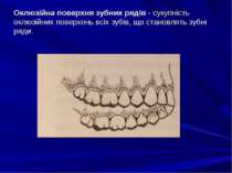 Оклюзійна поверхня зубних рядів - сукупність оклюзійних поверхонь всіх зубів,...