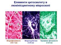 Елементи цитоскелету в люмінісцентному мікроскопі