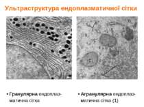 Ультраструктура ендоплазматичної сітки Гранулярна ендоплаз- матична сітка Агр...
