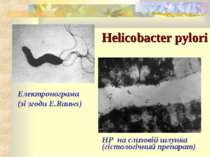 Helicobacter pylori Електронограма (зі згоди E.Rauws) НР на слизовій шлунка (...