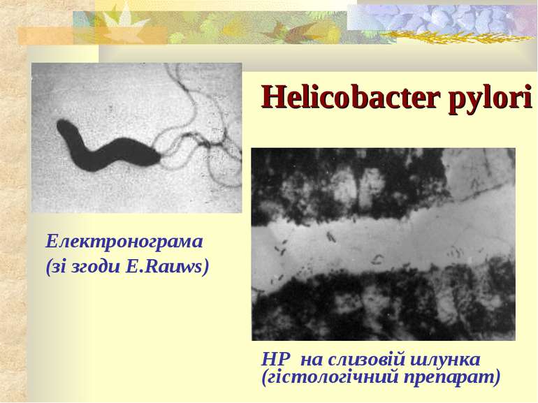 Helicobacter pylori Електронограма (зі згоди E.Rauws) НР на слизовій шлунка (...