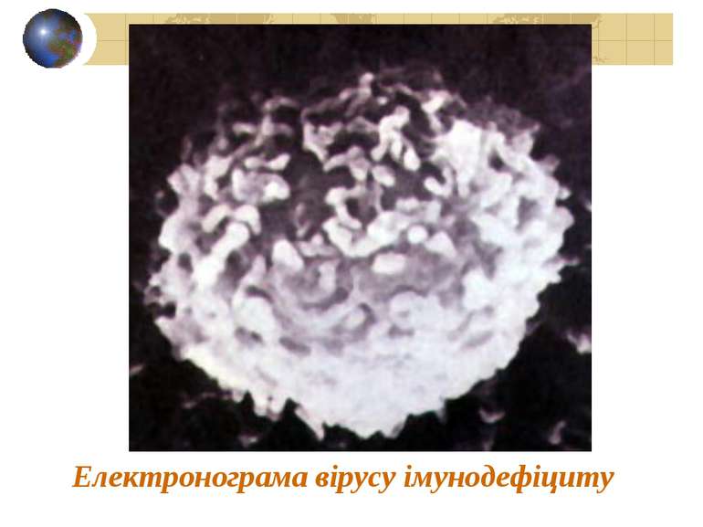 Електронограма вірусу імунодефіциту
