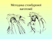 Методика стовбурової ваготомії