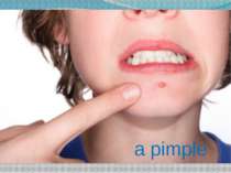 a pimple