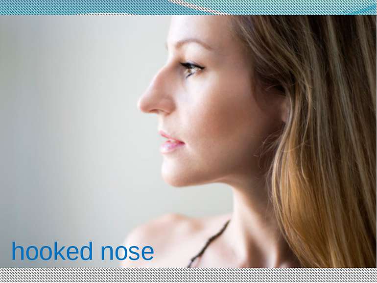 hooked nose