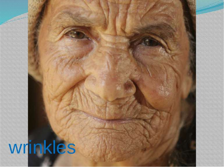 wrinkles