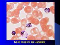 Кров хворого на малярію