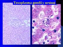 Toxoplasma gondii у печінці