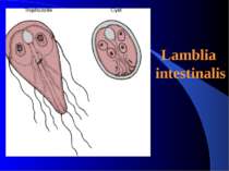 Lamblia intestinalis
