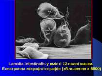 Lamblia intestinalis у вмісті 12-палої кишки. Електронна мікрофотографія (збі...
