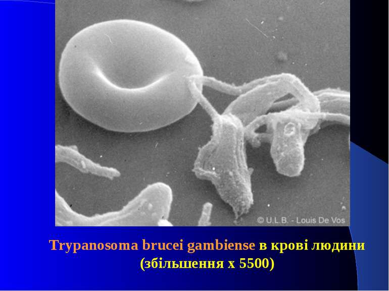Trypanosoma brucei gambiense в крові людини (збільшення x 5500)