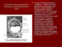 Трансмісійна електронна мікроскопія синусоїдного гемокапіляра печінки. х 14 0...