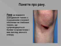 Поняття про рану. Рана- це відкрите ушкодження тканин з порушенням слизової о...