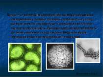 Віруси – це найменші мікроорганізми, які можуть викликати захворювання у люди...