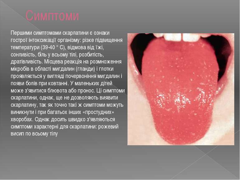 Симптоми Першими симптомами скарлатини є ознаки гострої інтоксикації організм...