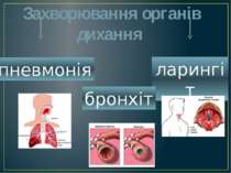 Захворювання органів дихання ларингіт бронхіт пневмонія