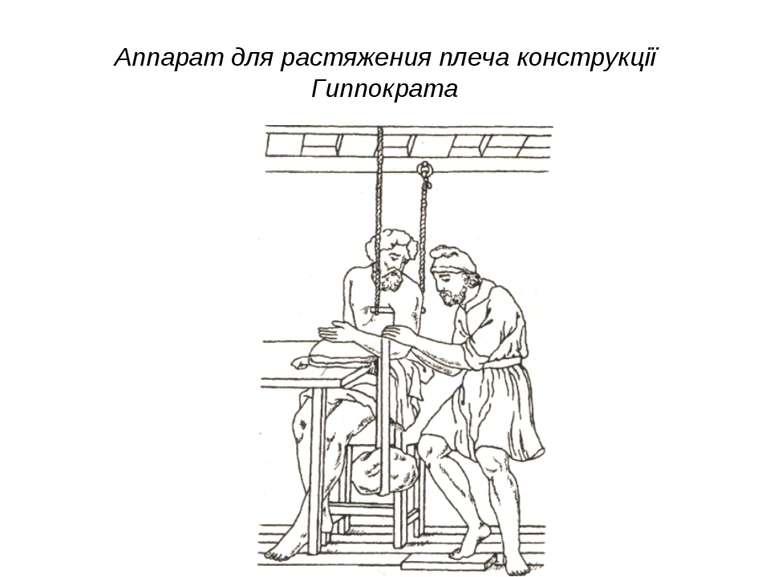 Аппарат для растяжения плеча конструкції Гиппократа