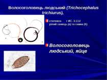 Волосоголовець людський (Trichocephalus trichiurus), статевоз- г ИС. 3.11U рі...