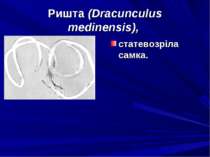 Ришта (Dracunculus medinensis), статевозріла самка.