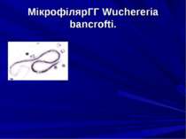 МікрофілярГГ Wuchereria bancrofti.