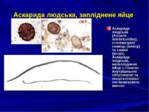 Аскарида людська, запліднене яйце Аскарида людська (Ascaris lumbricoides), ст...