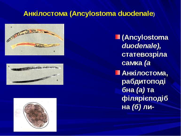 Анкілостома (Ancylostoma duodenale) (Ancylostoma duodenale), статевозріла сам...