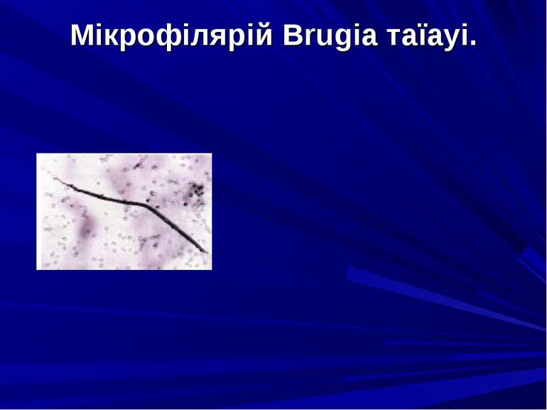 Мікрофілярій Brugia таїауі.