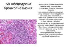 58 Абсцедуюча бронхопневмонія Інфільтрація сегментоядерними лейкоцитами, лімф...