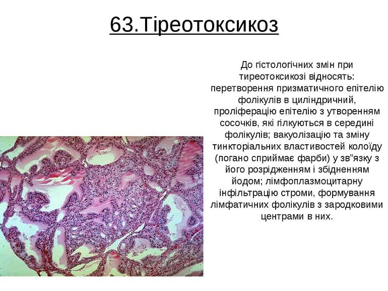 63.Тіреотоксикоз До гістологічних змін при тиреотоксикозі відносять: перетвор...