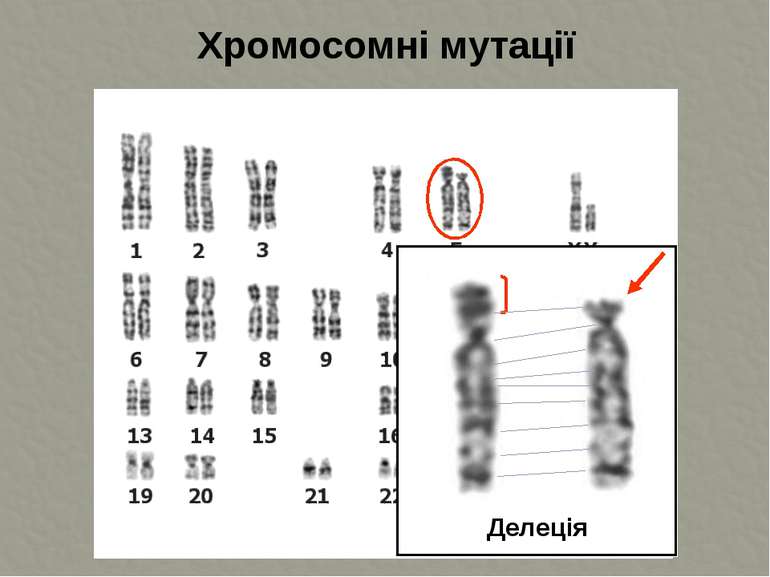 Хромосомні мутації Делеція