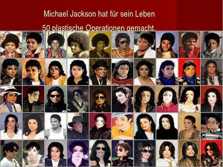 Michael Jackson hat für sein Leben 50 plastische Operationen gemacht.