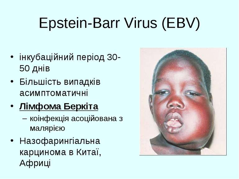 Epstein-Barr Virus (EBV) інкубаційний період 30-50 днів Більшість випадків ас...