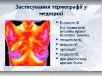 Застосування термографії у медицині В онкології (на термограмі пухлина правої...